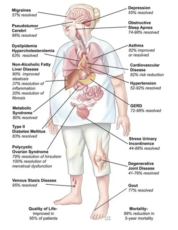 ObesityHelp