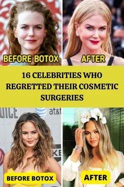 16 Celebrities Who Regretted Their Cosmetic Surgeries