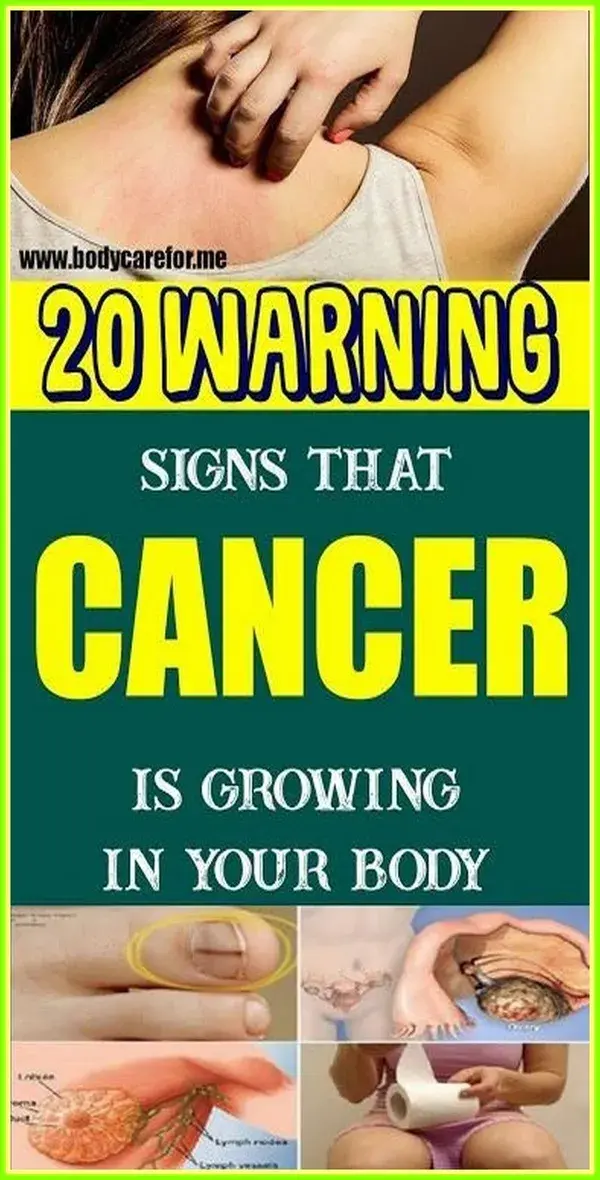 20 Warning Signs that Cancer is Growing in Your Body