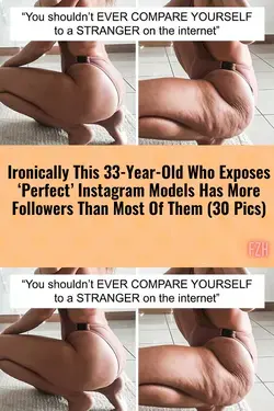 Ironically, This 33-Year-Old Who Exposes ‘Perfect’ Instagram Models Has More Followers Than Most Of