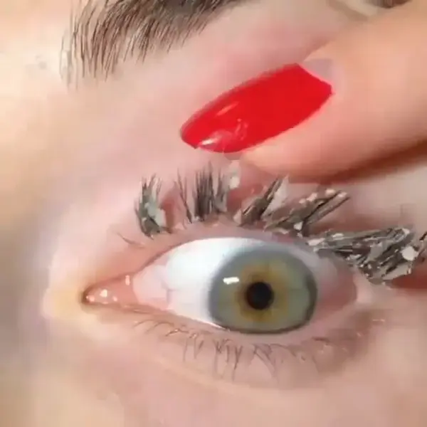 Eyelash removal😍