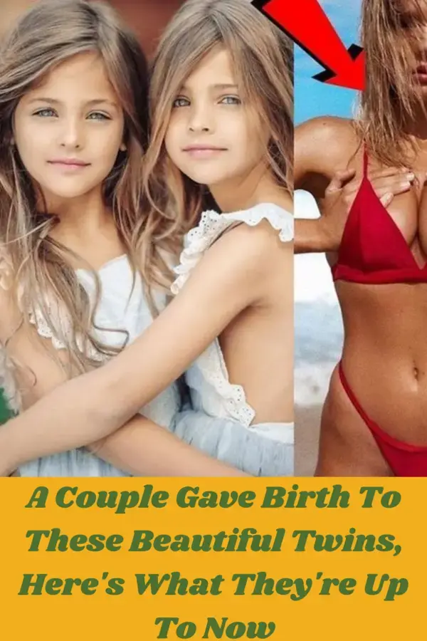 A Couple Gave Birth To These Beautiful Twins, Here's What They're Up To Now