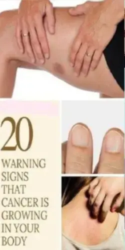20 warning signs that cancer is growing in your body