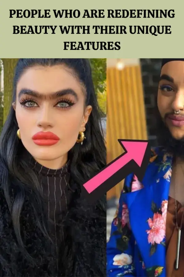 People Who Are Redefining Beauty With Their Unique Features