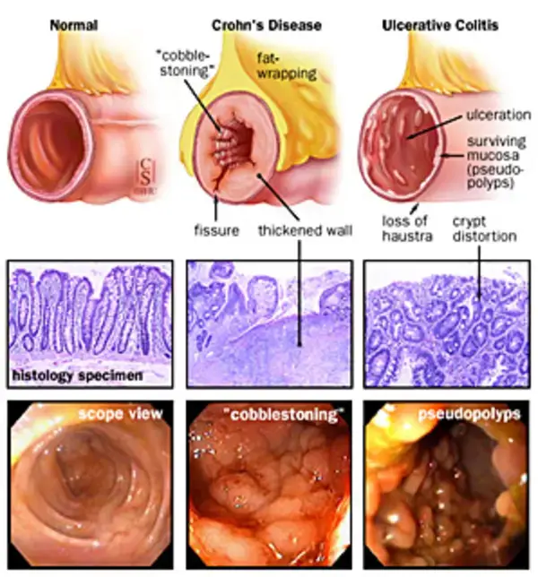 www.hopkinsmedicine.org