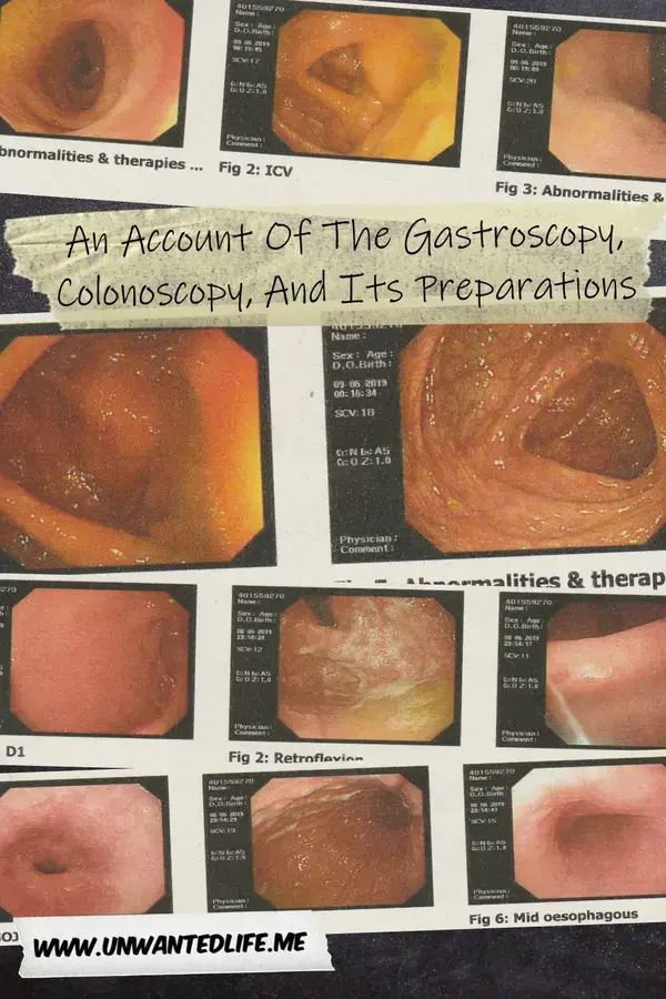 A Blow By Blow Account Of A Colonoscopy And A Gastroscopy Exam