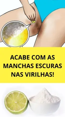 Como ACABAR com as MANCHAS ESCURAS nas Virilhas!