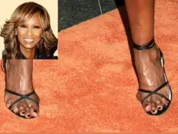 🌟 Celebrities are just like us - they suffer from uncomfortable bunions too! 🌟