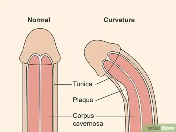 www.wikihow.com