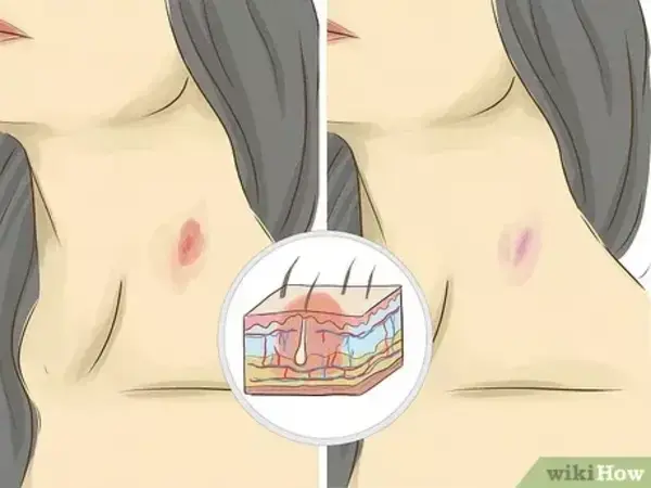 www.wikihow.com